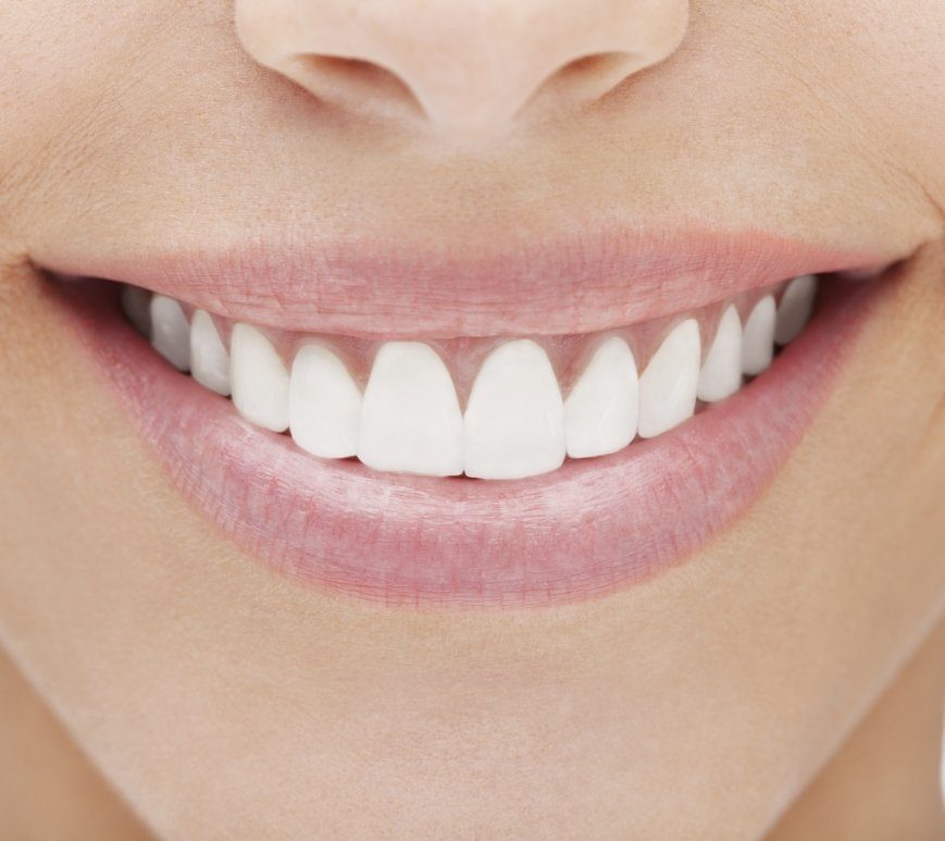 Close up of a smile with straight white teeth