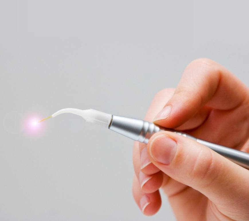 Hand holding a thin metal dental laser