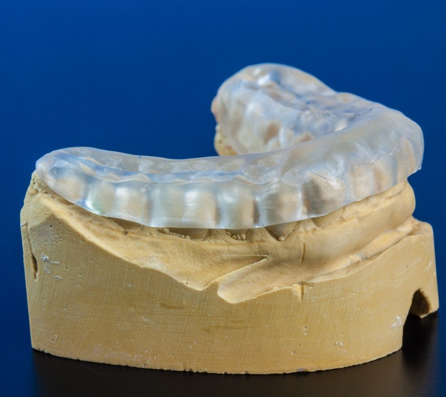 Model of the jaw with clear nightguard over the teeth